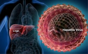 Waspada, 15 Kasus Hepatitis Akut Terdeteksi di Indonesia