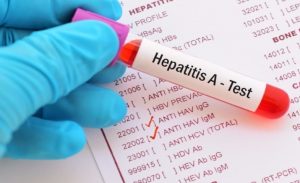 Kematian Hepatitis Akut Anak di RI Lebih Tinggi Dibanding AS-Inggris