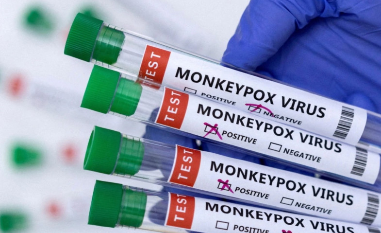 Jangan Anggap Enteng Cacar Monyet Bisa Jadi Ancaman Pandemi