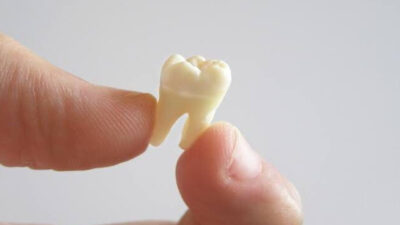 Apakah Gigi Geraham Copot atau Dicabut Bisa Tumbuh Lagi? Ini Panjelasan Ahli