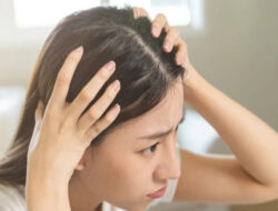 Sering Diabaikan, 5 Hal Ini Bikin Rambut Berketombe