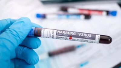 Cegah Virus Marburg, Dinkes DKI Minta Kurangi Kontak dengan Kelelawar