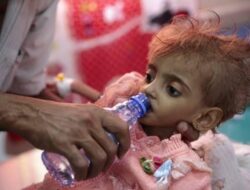 Miris! Ada 540 Ribu Anak di Yaman Menderita Kekurangan Gizi Akut