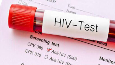 Kemenkes Temukan 5.100 Kasus Baru Ibu Rumah Tangga Terkena HIV