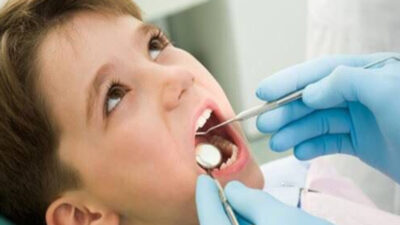 Bahaya Gula Terhadap Kesehatan Gigi dan Mulut