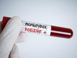 Monkeypox di Indonesia Bisa Tembus 3.600 Kasus