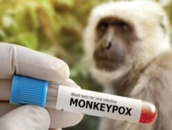 Kasus Cacar Monyet di Jakarta Bertambah Jadi 25 Orang