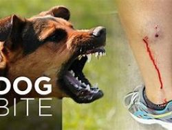 dog bite attorney san bernardino