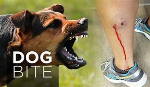 Featured image for dog bite attorney san bernardino